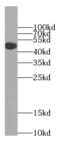 Tetratricopeptide Repeat Domain 8 antibody, FNab00824, FineTest, Western Blot image 