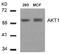 Protein kinase B antibody, AP08083PU-N, Origene, Western Blot image 
