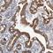 CPT2 antibody, NBP1-85471, Novus Biologicals, Immunohistochemistry frozen image 