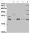 Proteasome Subunit Beta 9 antibody, TA322957, Origene, Western Blot image 