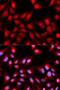 Probable ATP-dependent RNA helicase DDX5 antibody, LS-C333962, Lifespan Biosciences, Immunofluorescence image 