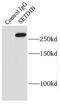 Histone-lysine N-methyltransferase SETD1B antibody, FNab07766, FineTest, Immunoprecipitation image 