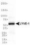 Lymphatic Vessel Endothelial Hyaluronan Receptor 1 antibody, TA336490, Origene, Western Blot image 