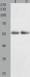 Histone Deacetylase 1 antibody, TA322693, Origene, Western Blot image 
