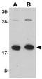 Zinc Finger CCHC-Type And RNA Binding Motif Containing 1 antibody, GTX85274, GeneTex, Western Blot image 