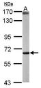 Peroxisomal carnitine O-octanoyltransferase antibody, TA307959, Origene, Western Blot image 