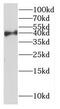 Lic3 antibody, FNab02587, FineTest, Western Blot image 