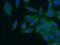 Rab GTPase-binding effector protein 1 antibody, 14350-1-AP, Proteintech Group, Immunofluorescence image 