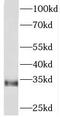 Phosphatidylinositol Transfer Protein Alpha antibody, FNab06470, FineTest, Western Blot image 