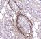 Amyloid P Component, Serum antibody, A00162, Boster Biological Technology, Immunohistochemistry paraffin image 