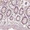 Fascin Actin-Bundling Protein 1 antibody, HPA050654, Atlas Antibodies, Immunohistochemistry frozen image 
