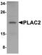 Placenta-specific protein 2 antibody, NBP1-76486, Novus Biologicals, Western Blot image 
