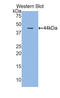 Cathelicidin antibody, LS-C299325, Lifespan Biosciences, Western Blot image 
