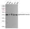Mitogen-activated protein kinase 3 antibody, STJ99308, St John