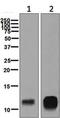 Platelet Factor 4 antibody, ab129183, Abcam, Western Blot image 