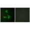 Cyclin Dependent Kinase Inhibitor 2B antibody, A01500-1, Boster Biological Technology, Immunohistochemistry frozen image 