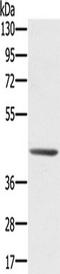 Retinoid-inducible serine carboxypeptidase antibody, TA350356, Origene, Western Blot image 