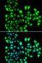 Small Nuclear Ribonucleoprotein D2 Polypeptide antibody, 14-942, ProSci, Immunofluorescence image 