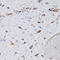 VP antibody, A00384-1, Boster Biological Technology, Immunohistochemistry frozen image 