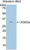 Cytochrome P450 Family 26 Subfamily A Member 1 antibody, MBS2013628, MyBioSource, Western Blot image 
