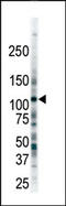 Fms Related Tyrosine Kinase 3 antibody, AP14353PU-N, Origene, Western Blot image 
