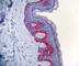 Keratin 1 antibody, 906004, BioLegend, Immunohistochemistry paraffin image 