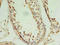 PIN1 antibody, orb356079, Biorbyt, Immunohistochemistry paraffin image 