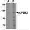 Adaptor Related Protein Complex 3 Subunit Beta 2 antibody, MBS151160, MyBioSource, Western Blot image 