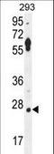 Leucine Rich Repeat Containing 57 antibody, LS-C165889, Lifespan Biosciences, Western Blot image 