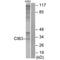 Calcium And Integrin Binding Family Member 3 antibody, A14232, Boster Biological Technology, Western Blot image 