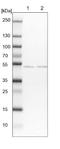 Makorin Ring Finger Protein 2 antibody, NBP1-83179, Novus Biologicals, Western Blot image 