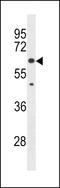 Kelch Like Family Member 30 antibody, LS-C157854, Lifespan Biosciences, Western Blot image 