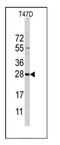 Phosphatidylethanolamine N-Methyltransferase antibody, AP11038PU-N, Origene, Western Blot image 