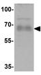GDNF Inducible Zinc Finger Protein 1 antibody, GTX32070, GeneTex, Western Blot image 