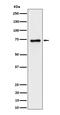 Protein Tyrosine Phosphatase Receptor Type R antibody, M06905, Boster Biological Technology, Western Blot image 