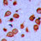 Serine/threonine-protein kinase LMTK3 antibody, LS-C358796, Lifespan Biosciences, Immunohistochemistry paraffin image 