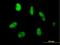 Zinc Finger Protein 331 antibody, H00055422-B01P, Novus Biologicals, Immunocytochemistry image 