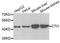 Cystathionine Gamma-Lyase antibody, A6121, ABclonal Technology, Western Blot image 