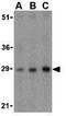 B Cell Receptor Associated Protein 31 antibody, GTX31726, GeneTex, Western Blot image 