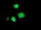 Musashi RNA Binding Protein 1 antibody, NBP2-03434, Novus Biologicals, Immunofluorescence image 