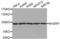 KH-Type Splicing Regulatory Protein antibody, abx004640, Abbexa, Western Blot image 