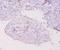 Metallothionein 1E antibody, A57577-100, Epigentek, Immunohistochemistry paraffin image 