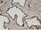Zinc Fingers And Homeoboxes 3 antibody, LS-C134042, Lifespan Biosciences, Immunohistochemistry paraffin image 
