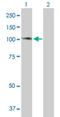 ATM Interactor antibody, H00023300-B01P, Novus Biologicals, Western Blot image 