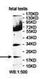 ADP Ribosylation Factor Like GTPase 16 antibody, orb78422, Biorbyt, Western Blot image 