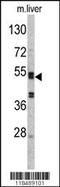 SERPINC1 antibody, TA324863, Origene, Western Blot image 