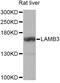 Laminin subunit beta-3 antibody, LS-C748701, Lifespan Biosciences, Western Blot image 