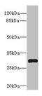 Synaptoporin antibody, A61222-100, Epigentek, Western Blot image 