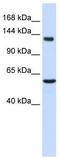 Immunoglobulin Superfamily Member 1 antibody, TA346295, Origene, Western Blot image 