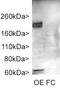 AC-III antibody, LS-C204505, Lifespan Biosciences, Western Blot image 